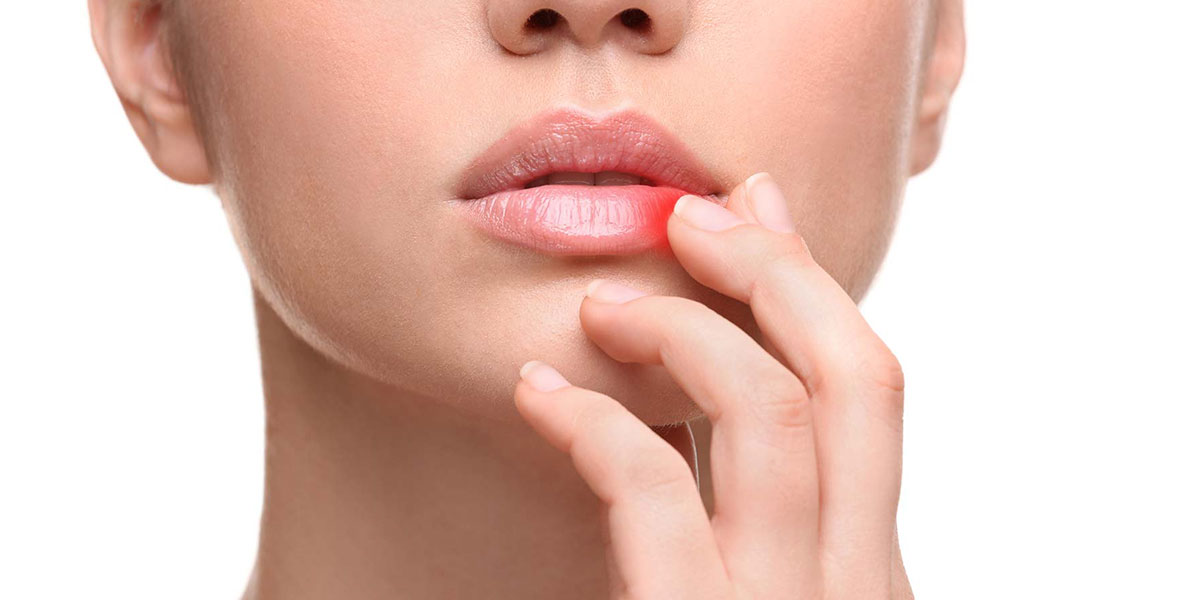 Lippenkrebs