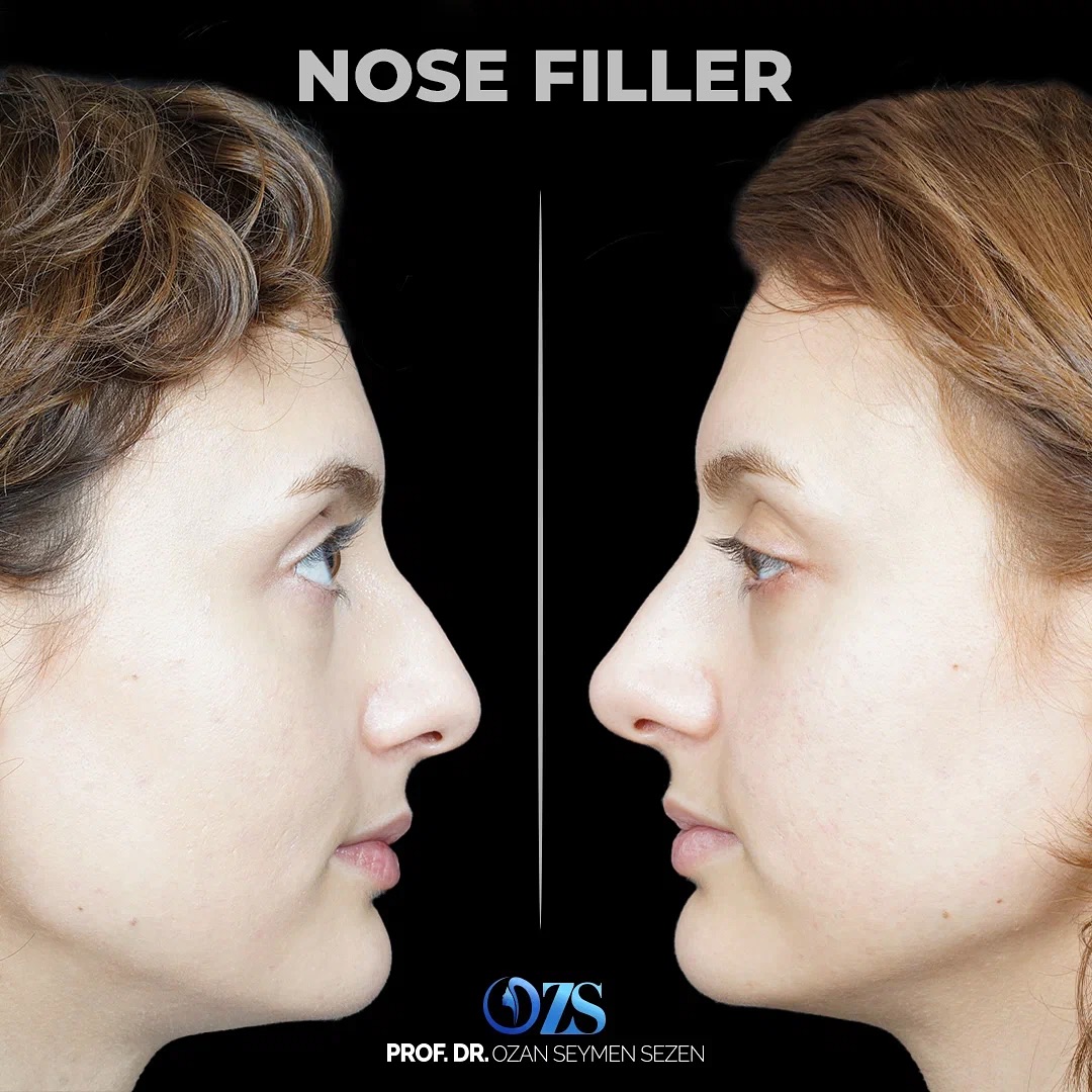 before-after