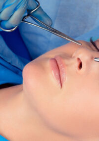 Frequently Asked Questions About Rhinoplasty