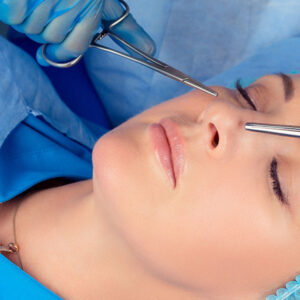 Frequently Asked Questions About Rhinoplasty