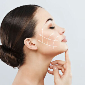 Midface Lift Surgery