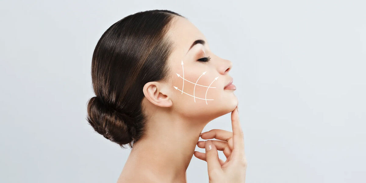 Midface Lift Surgery