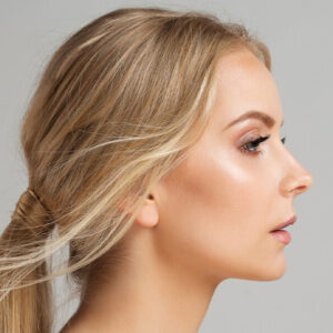 Revision Rhinoplasty
