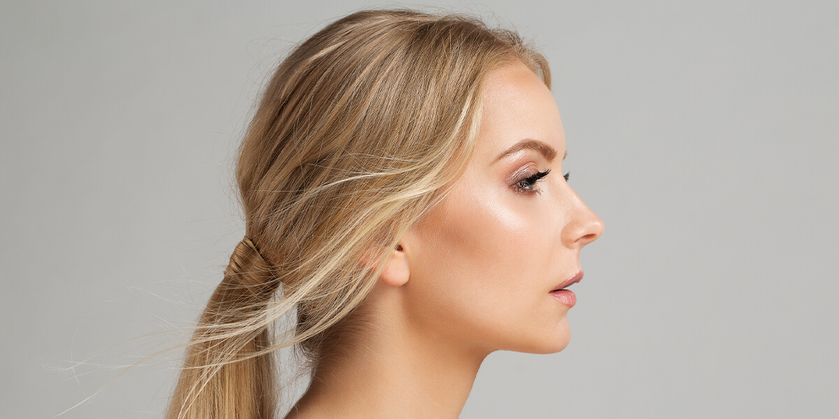 Revision Rhinoplasty
