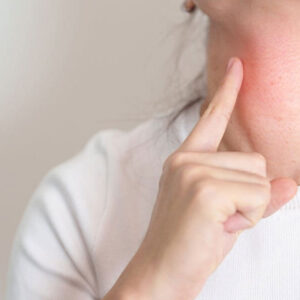 Salivary Gland Cancer