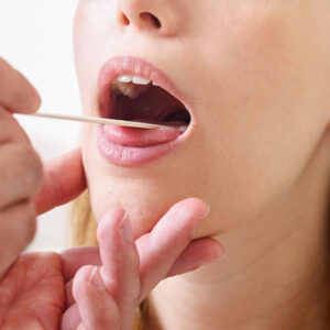 Tonsillectomy