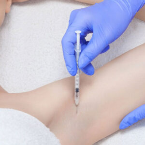 Underarm Sweating Botox