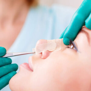 What Are the Surgical Methods in Rhinoplasty?