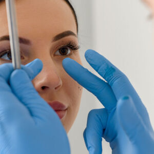 What Is Nose Aesthetics (Rhinoplasty)? Who Is It Suitable For?